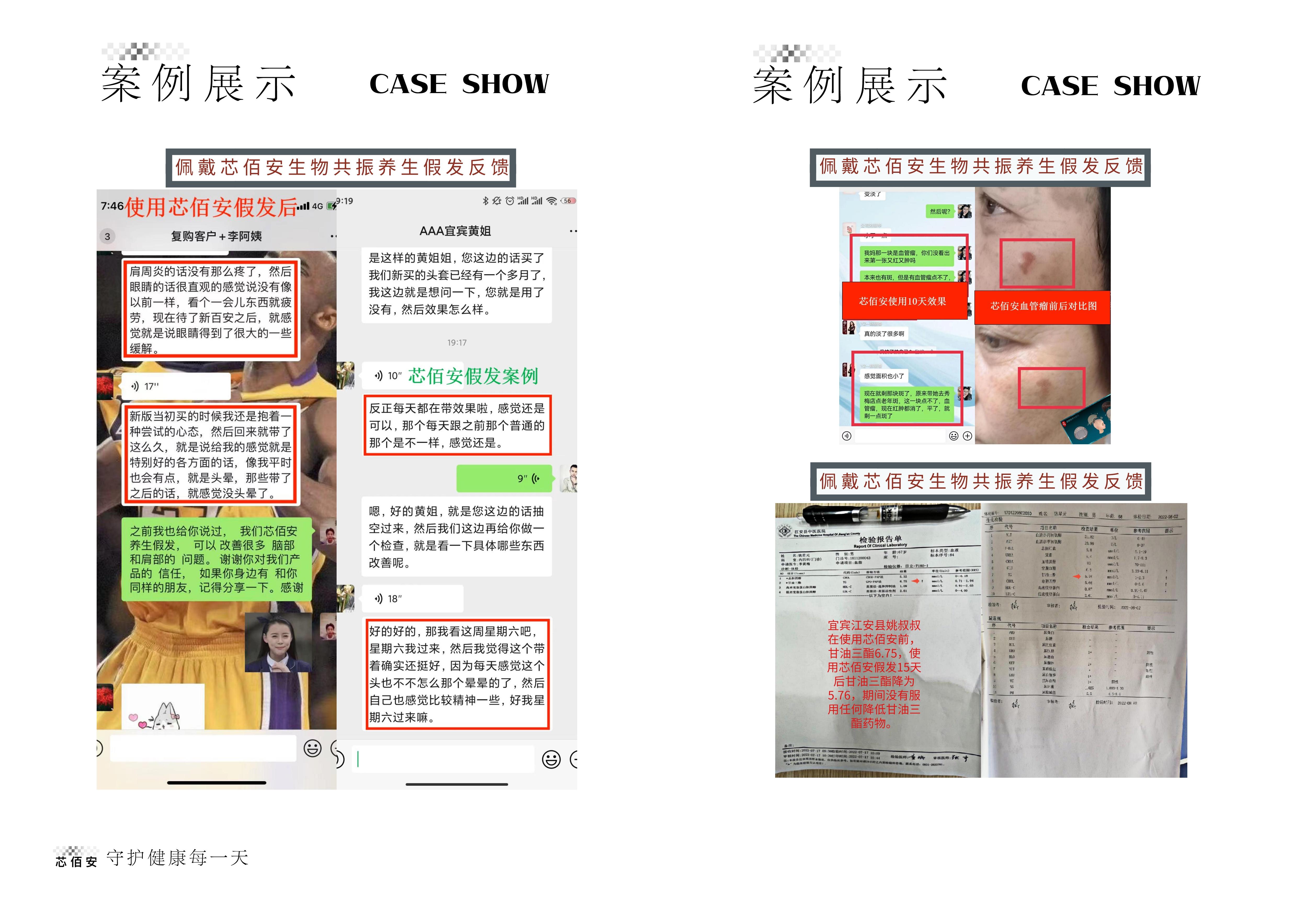 佩戴芯佰安生物共振养生假发反馈